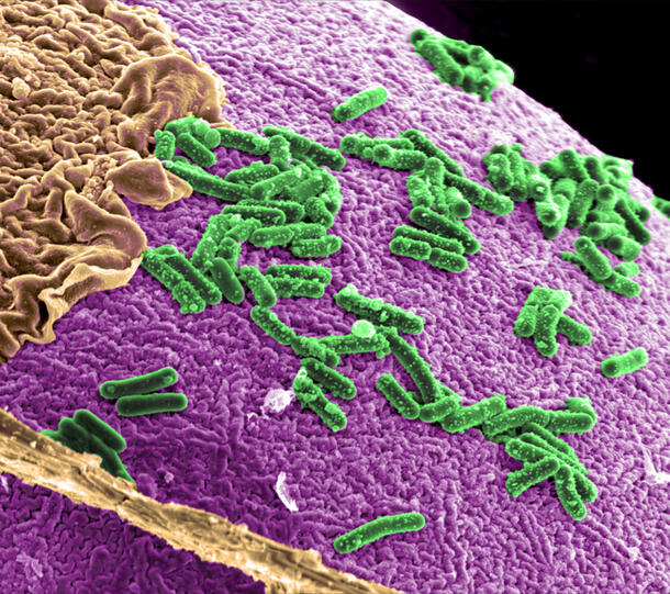 Rendering of clusters of colorful pill-shaped bacteria on a textured surface.