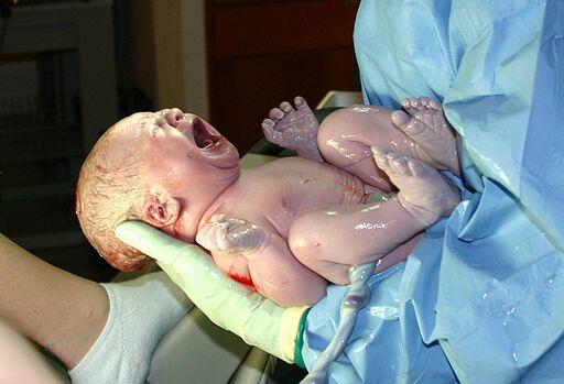 A newborn baby held by a medical professional wearing gloves and a smock.