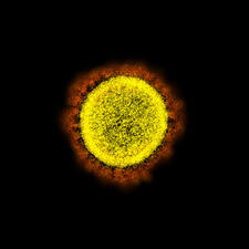 Microscopic image of a single SARS-CoV-2 virus.