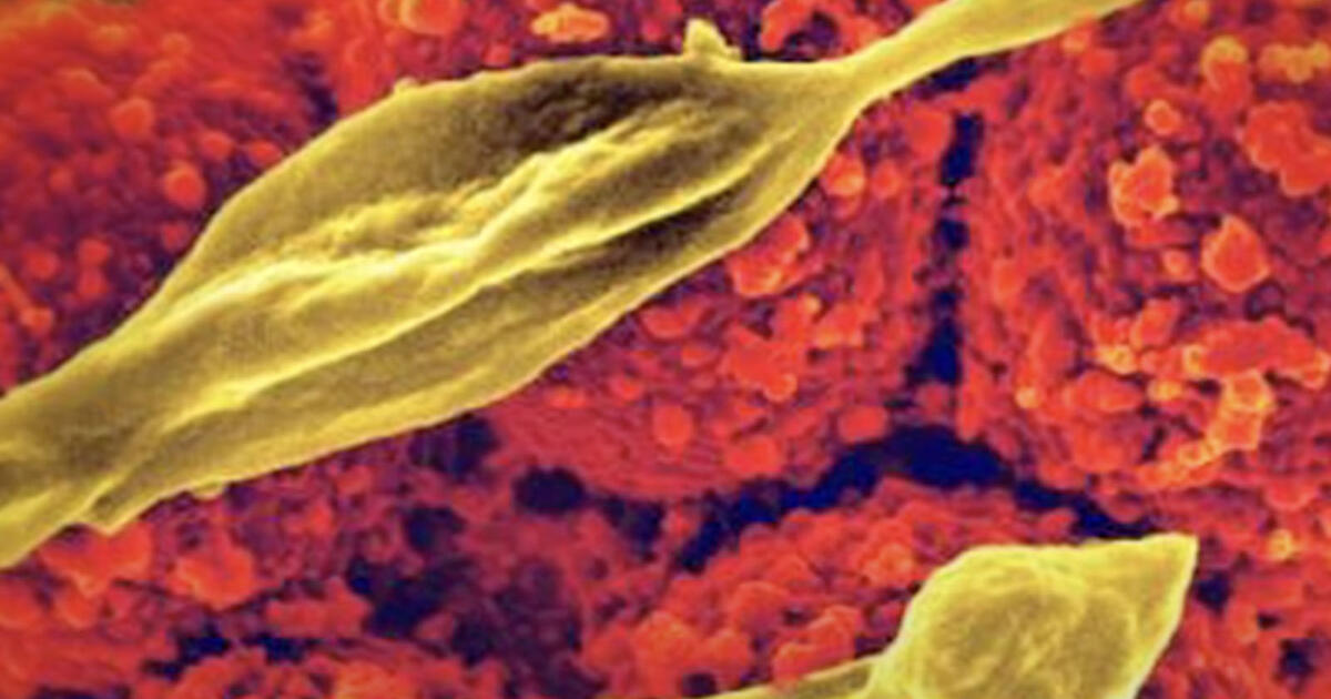 MRSA: When Good Bacteria Go Bad | AMNH